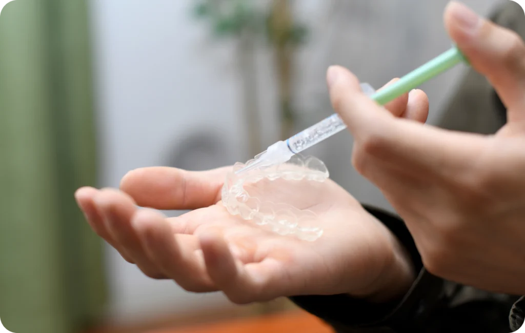 Éclaircissement dentaire Immersion dentaire, Dentiste à Carnac