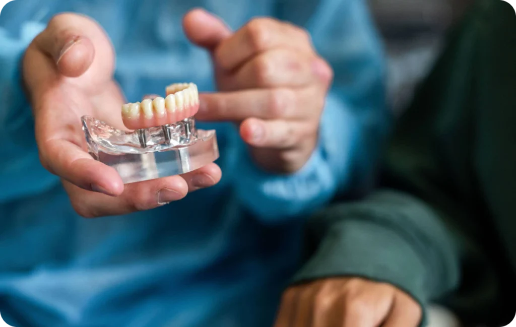 Prothèses amovibles à Carnac Immersion dentaire, Dentiste à Carnac
