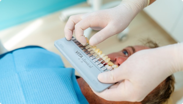 Facettes dentaires à Carnac Immersion dentaire, Dentiste à Carnac