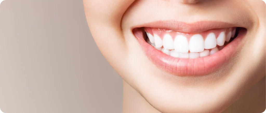 Éclaircissement dentaire Immersion dentaire, Dentiste à Carnac