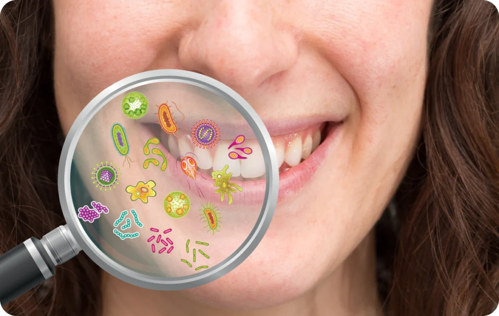 Soins des gencives (parodontologie) Immersion dentaire, Dentiste à Carnac