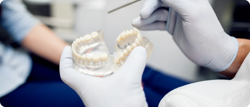 Prothèses amovibles à Carnac Immersion dentaire, Dentiste à Carnac