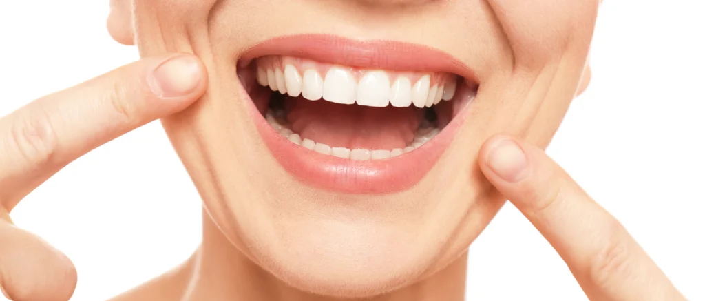 Éclaircissement dentaire Immersion dentaire, Dentiste à Carnac