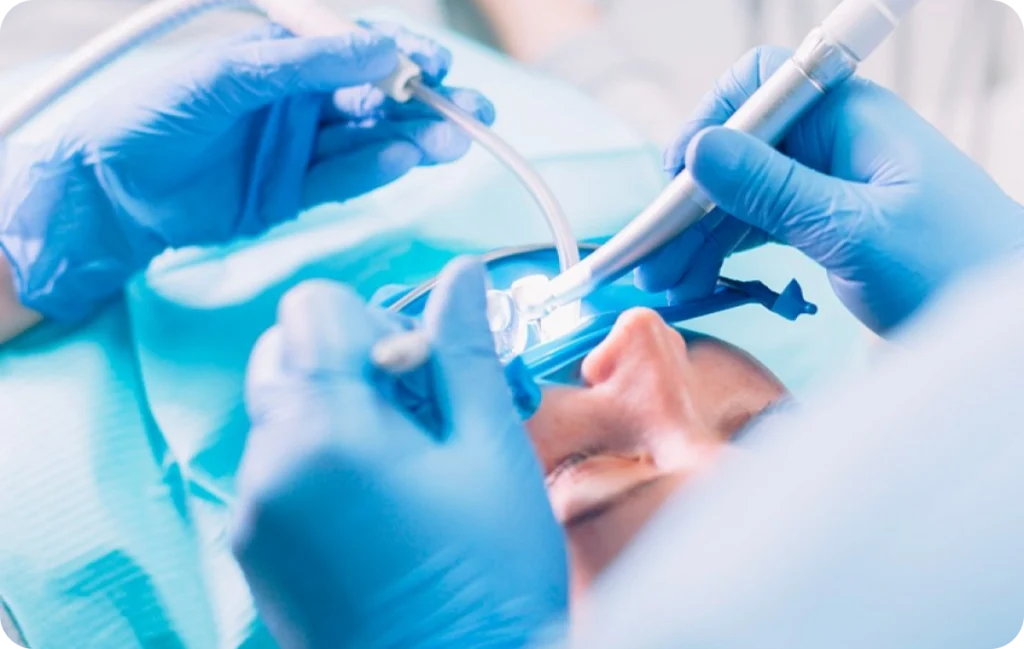 Conseils post-opératoires Immersion dentaire, Dentiste à Carnac