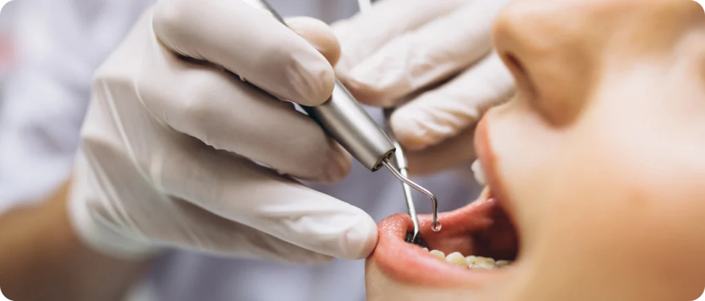 Conseils pré-opératoires Immersion dentaire, Dentiste à Carnac