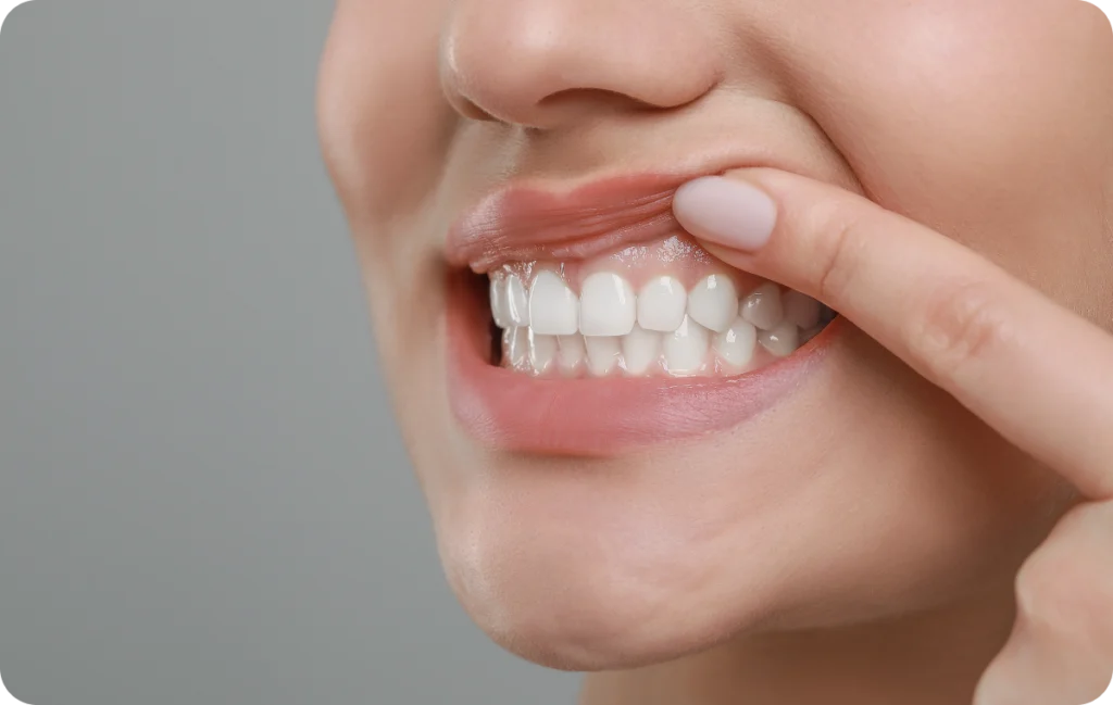 Hygiène bucco-dentaire Immersion dentaire, Dentiste à Carnac