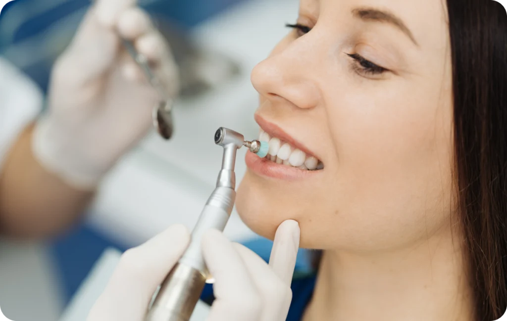 Éclaircissement dentaire Immersion dentaire, Dentiste à Carnac