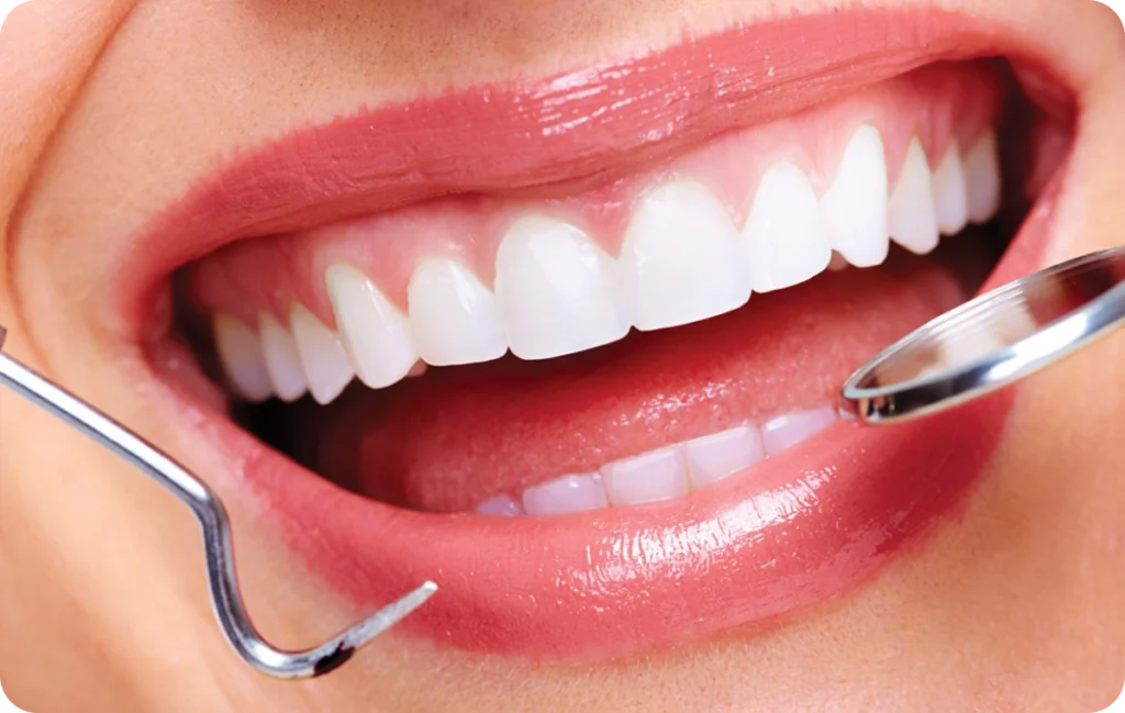 Greffe gingivale Immersion dentaire, Dentiste à Carnac