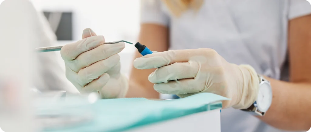 Soins courants en composite Immersion dentaire, Dentiste à Carnac