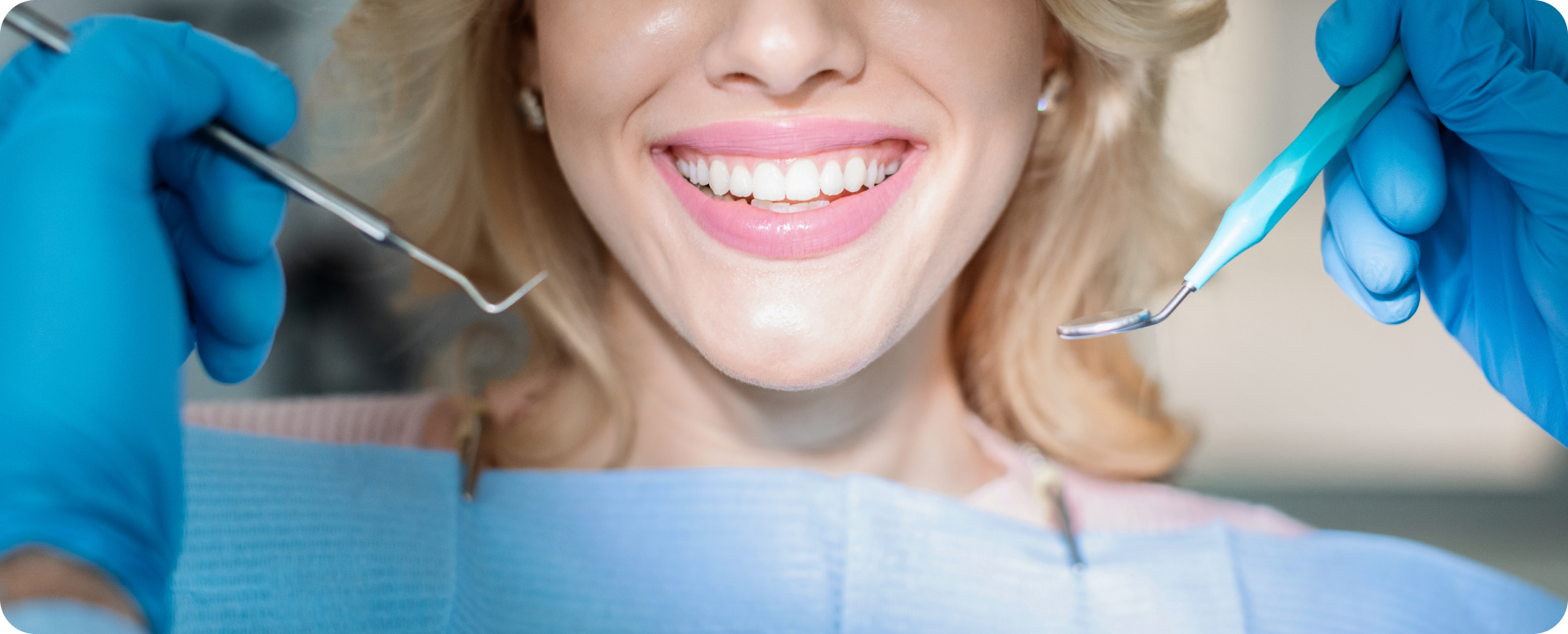 Traitement des tâches dentaires à Carnac Immersion dentaire, Dentiste à Carnac