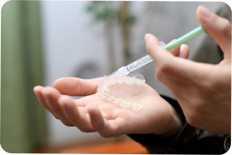 Traitement des tâches dentaires à Carnac Immersion dentaire, Dentiste à Carnac