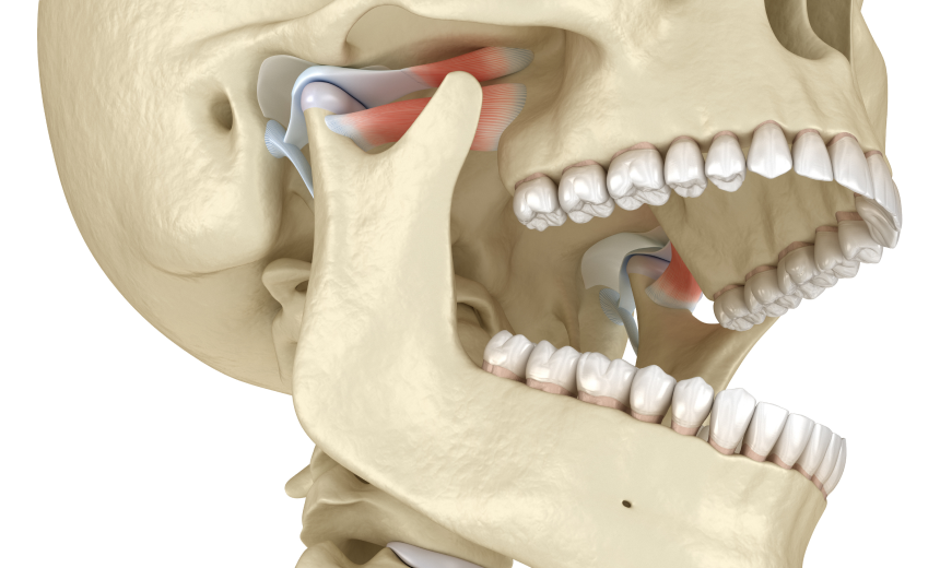 Bruxisme Immersion dentaire, Dentiste à Carnac