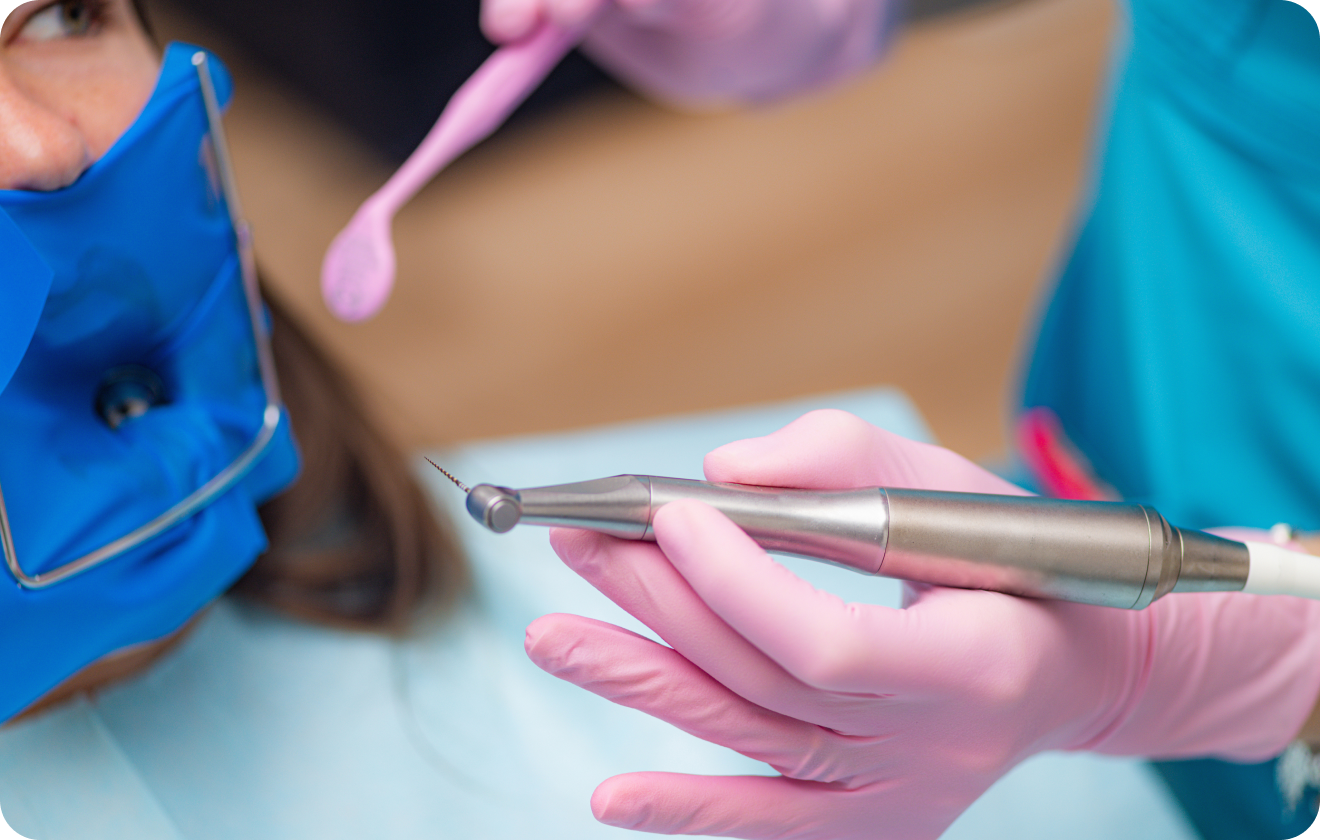 Retraitement endodontique, Immersion dentaire, Dentiste à Carnac
