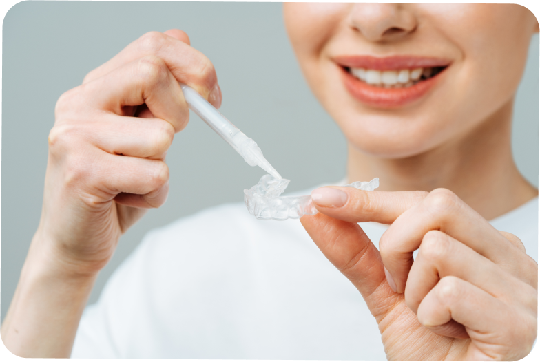 Traitement des tâches dentaires à Carnac Immersion dentaire, Dentiste à Carnac