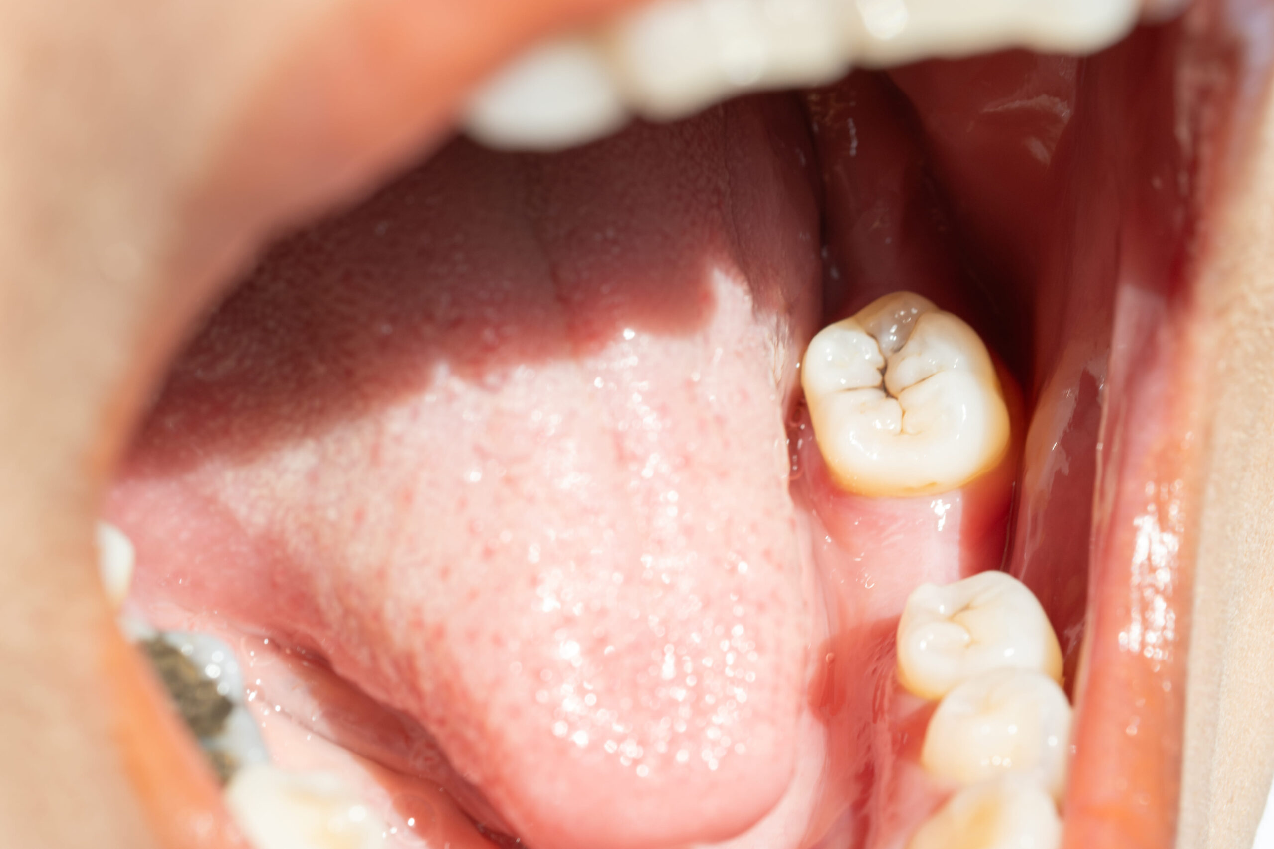 Vos besoins Immersion dentaire, Dentiste à Carnac