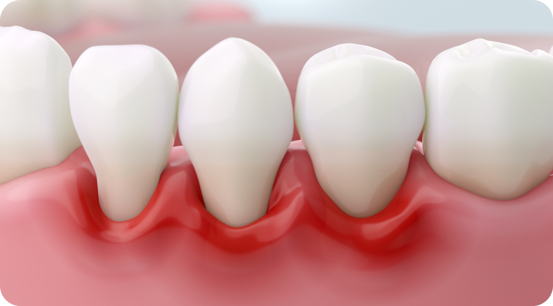 Vos besoins Immersion dentaire, Dentiste à Carnac