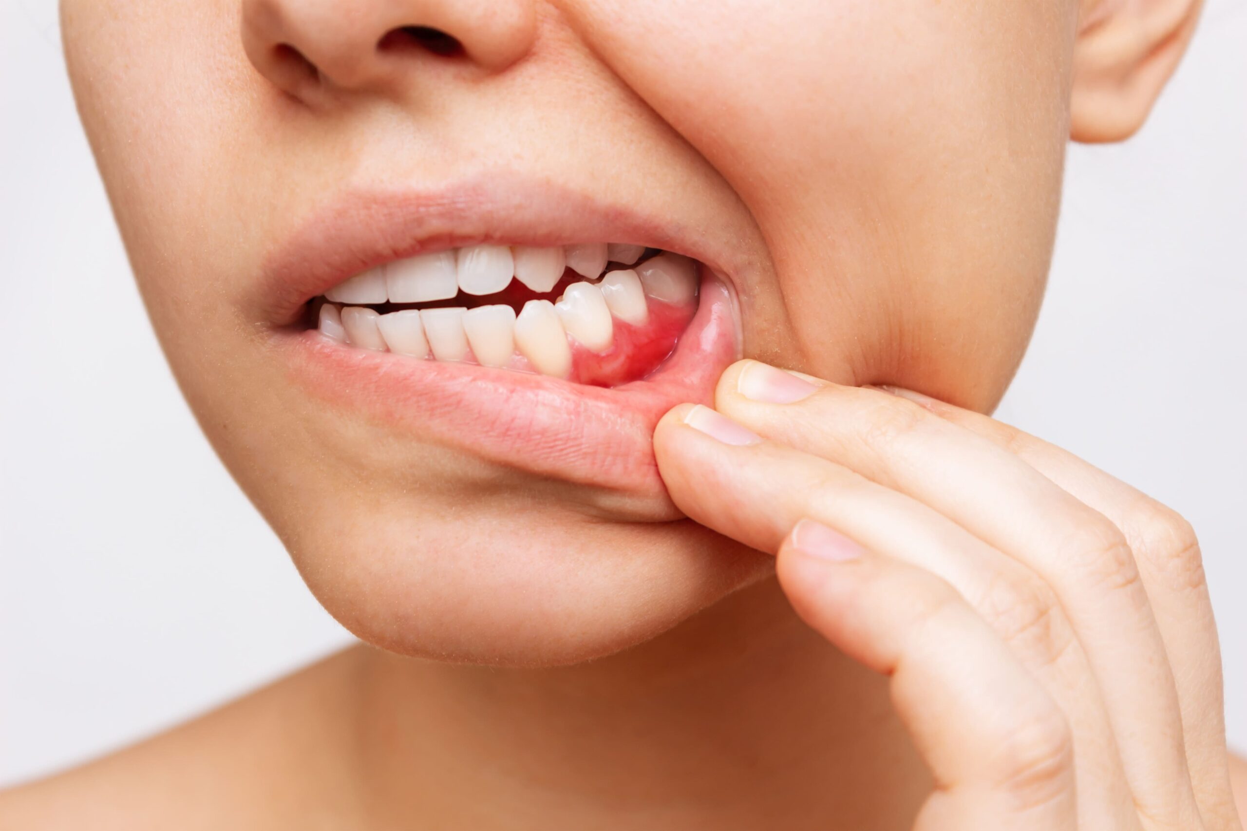 Vos besoins Immersion dentaire, Dentiste à Carnac