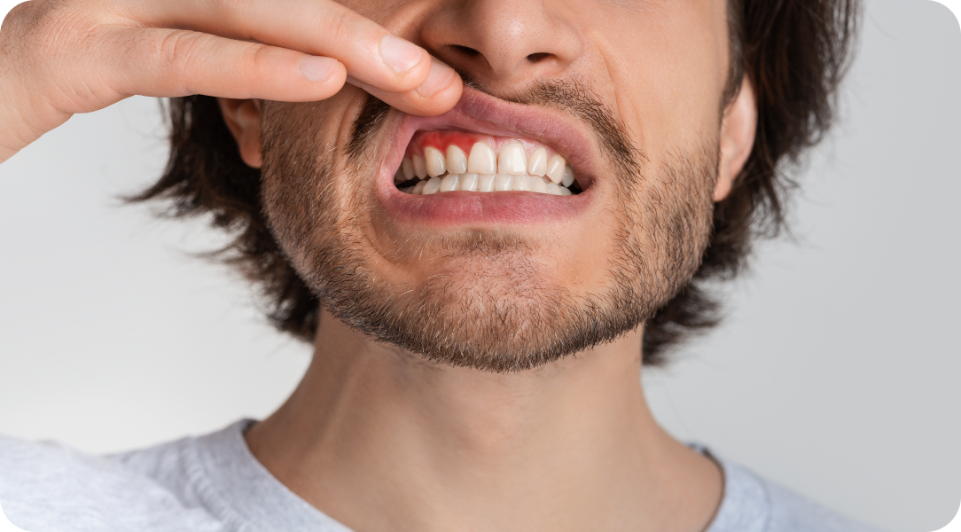 Vos besoins Immersion dentaire, Dentiste à Carnac