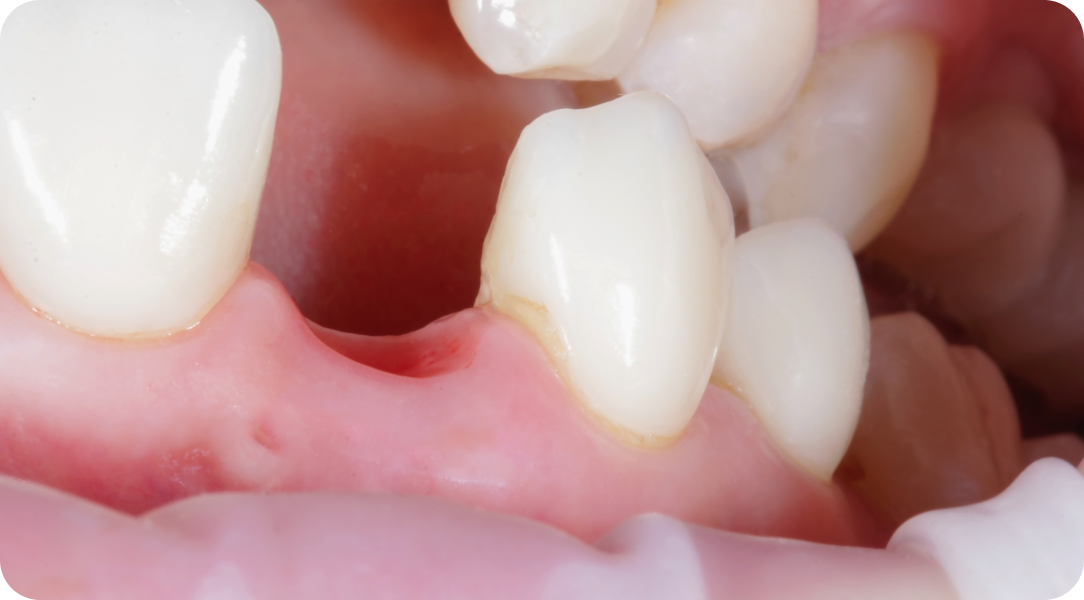 Vos besoins Immersion dentaire, Dentiste à Carnac